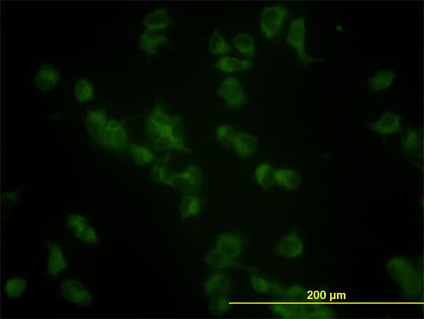 GBA / Glucosidase Beta Acid Antibody (clone 2e2)