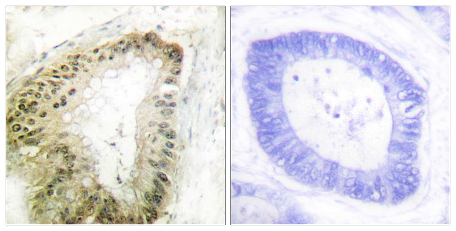 STK11 / LKB1 Antibody (phospho-Ser428)
