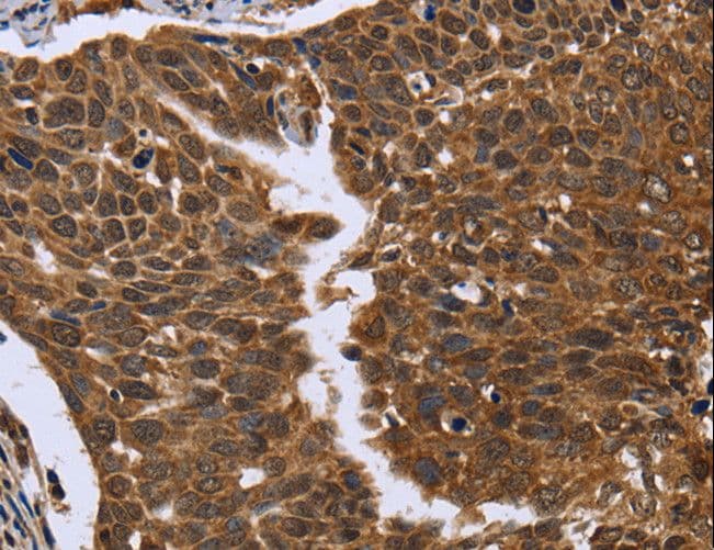 Polyclonal Rabbit anti-Human FGFR1OP / FOP Antibody (IHC)