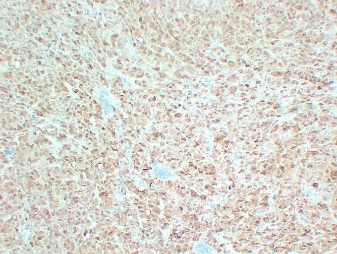 S100B / S100 Beta Antibody (clone ABT-S100B)