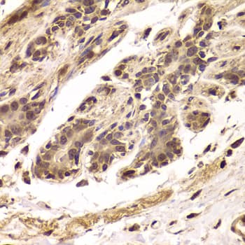 Polyclonal Rabbit anti-Human TDO2 Antibody (IHC, WB)