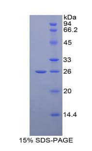 Human GRIP1 Protein (Recombinant His-T7)
