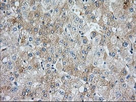 BIRC5 / Survivin Antibody (clone OTI2D9)