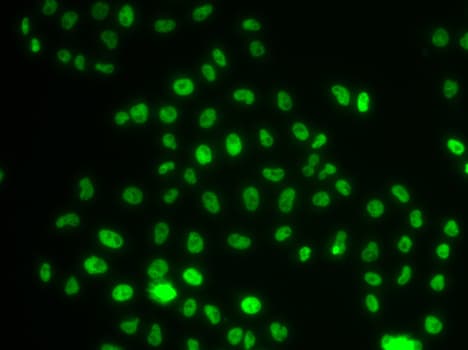WDR11 / PHIP Antibody
