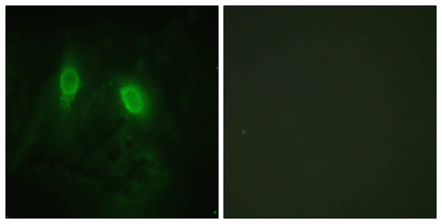 IKBKG / NEMO / IKK Gamma Antibody (p85)
