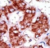CPT1B Antibody (aa606-637)