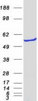 Human IMPDH2 Protein (Recombinant Myc-DDK (Flag))