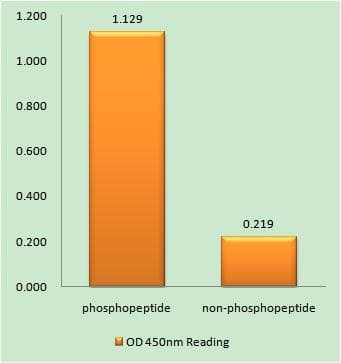 IGFBP3 Antibody (phospho-Ser183)