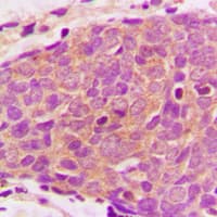 AKT1S1 / PRAS40 Antibody (C-Terminus)