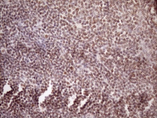 Monoclonal Mouse anti-Human WTAP Antibody (clone OTI12G6, aa2-106, IHC, WB)