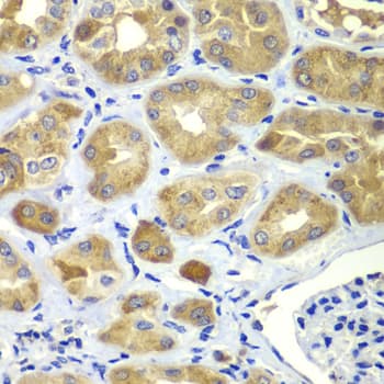p66 / SHC Antibody