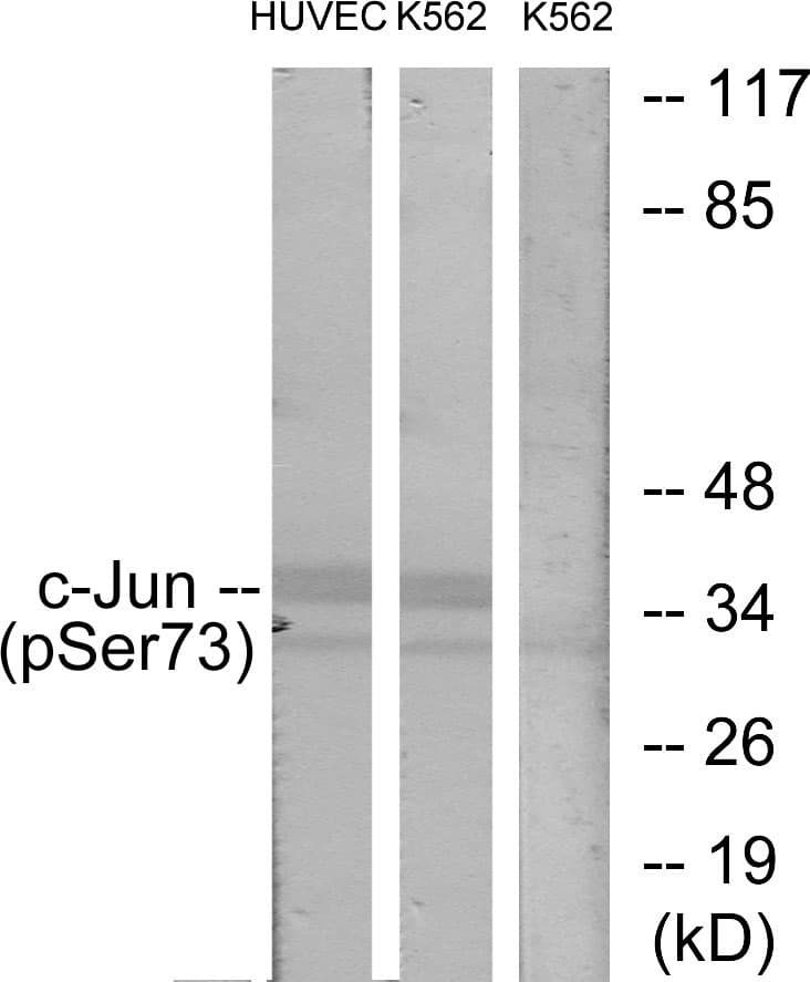 Polyclonal Rabbit anti-Human JUN / c-Jun Antibody (phospho-Ser73, IHC, WB)