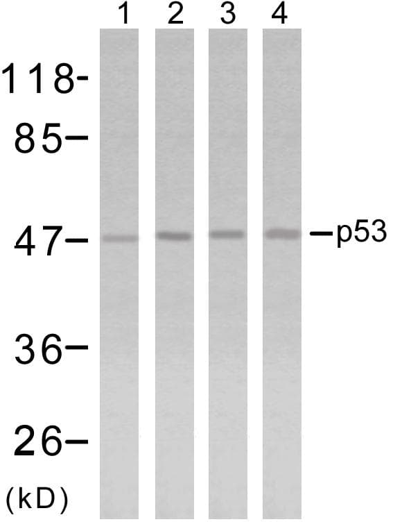 TP53 / p53 Antibody (p315)