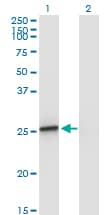 Monoclonal Mouse anti-Human AMELX Antibody (clone 5B2, WB)