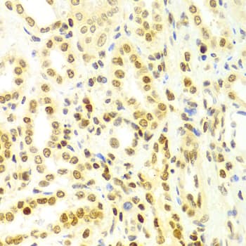 Polyclonal Rabbit anti-Human DKC1 / Dyskerin Antibody (IHC, IF, WB)