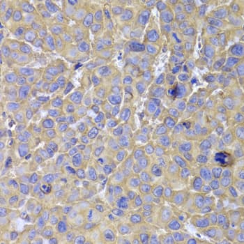 HSP70L1 / HSPA14 Antibody