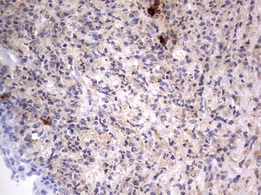 Monoclonal Mouse anti-Human SMPD1 / Acid Sphingomyelinase Antibody (clone OTI3H7, aa62-341, IHC, WB)