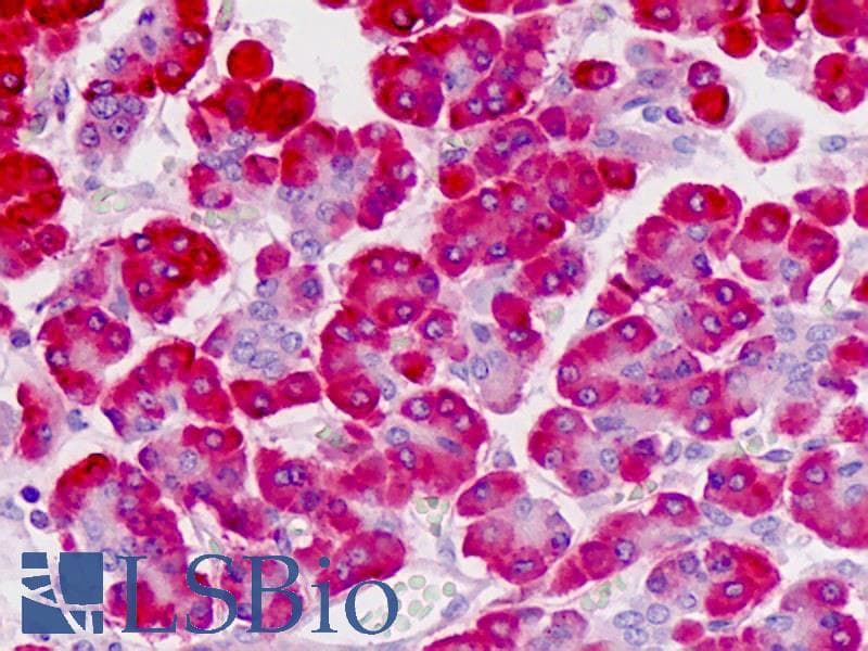 IHC-plus™ FKBP11 Antibody (aa52-82)