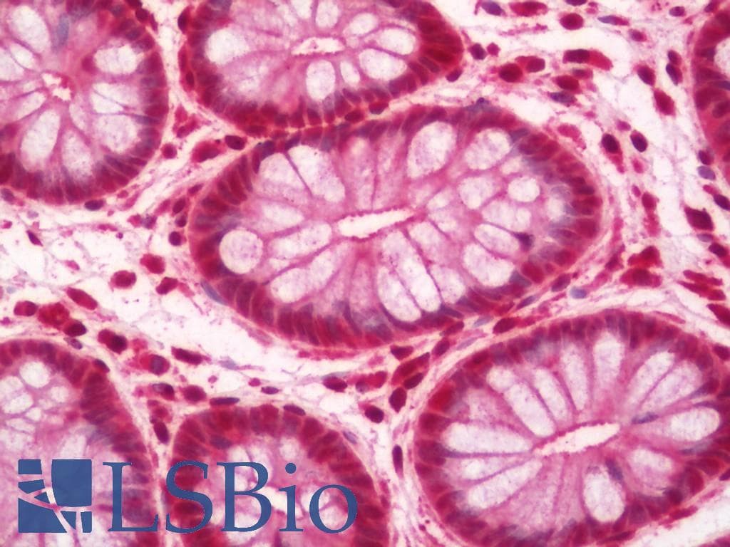 IHC-plus™ PHF5A / INI Antibody