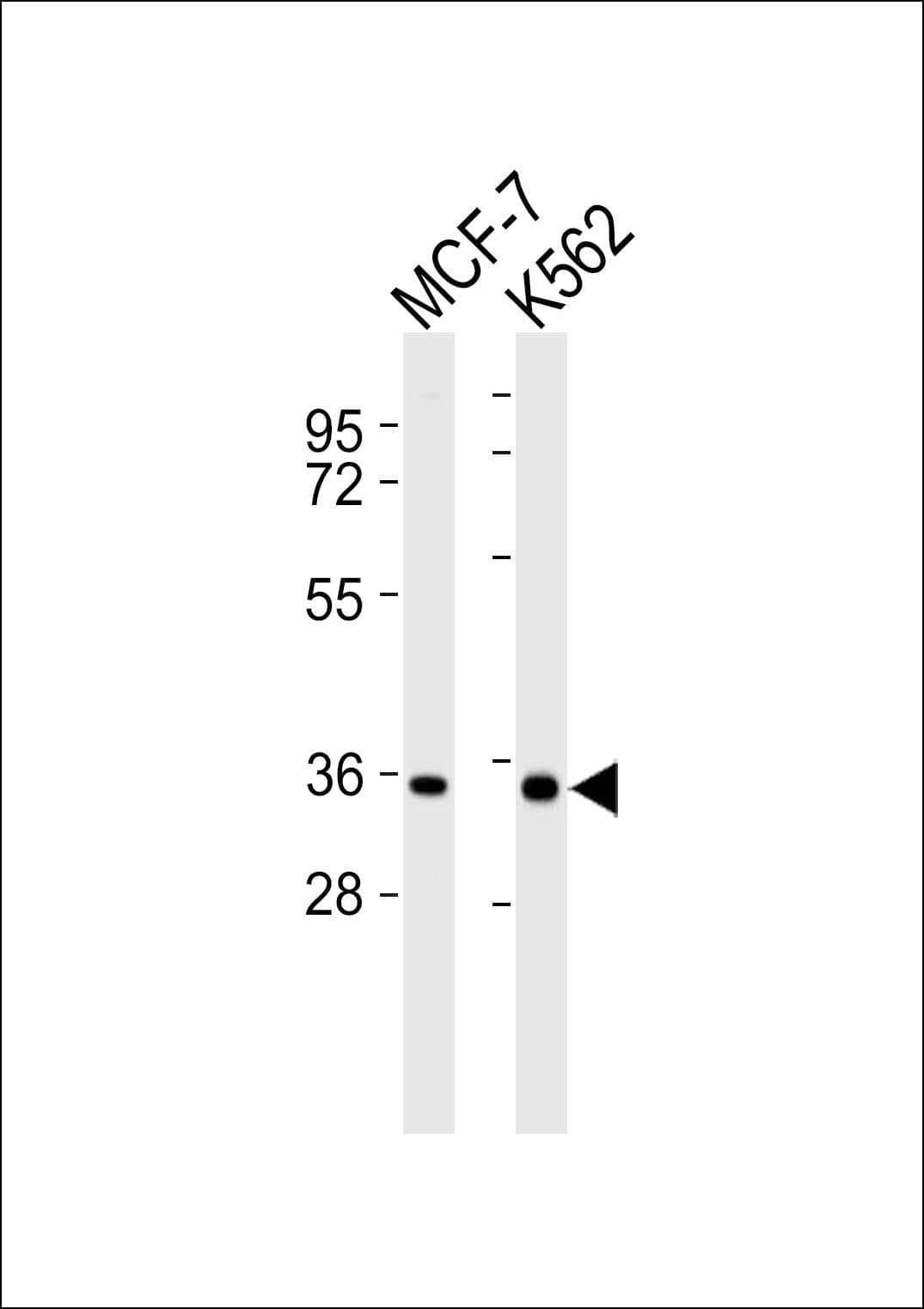 Polyclonal Rabbit anti-Human MRPL15 Antibody (WB)