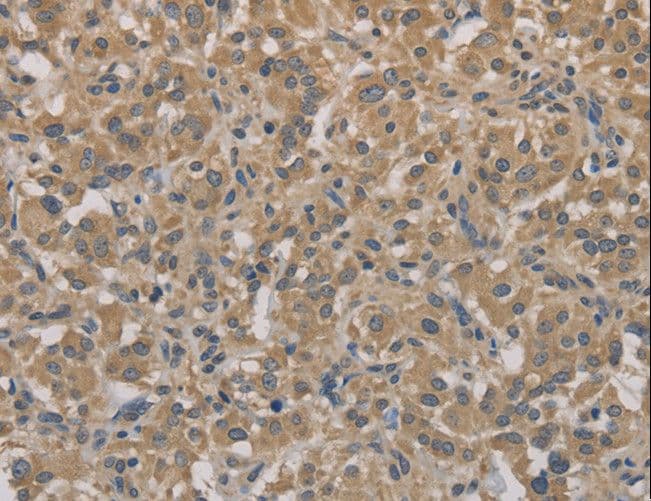 AGTRAP / ATRAP Antibody