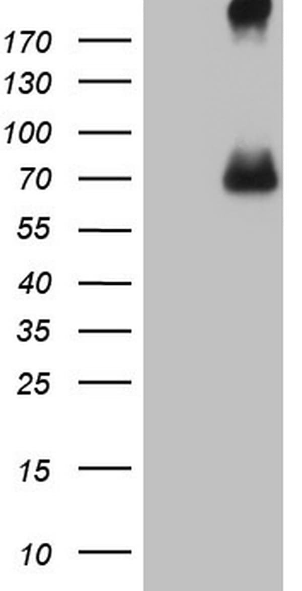 CFI / Complement Factor I Antibody (aa340-583, clone OTI4A8)