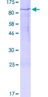 Human RPS6KB1 / P70S6K / S6K Protein (Recombinant GST)