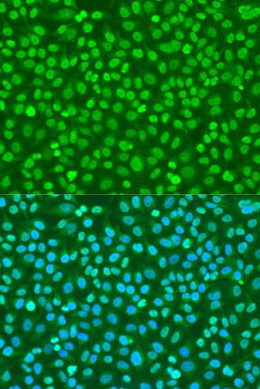 H2AFX / H2AX Antibody