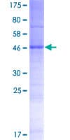 Human TMEM116 Protein (Recombinant GST)