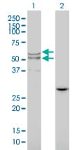 IHC-plus™ LIPA / Lysosomal Acid Lipase Antibody (clone 1F9)