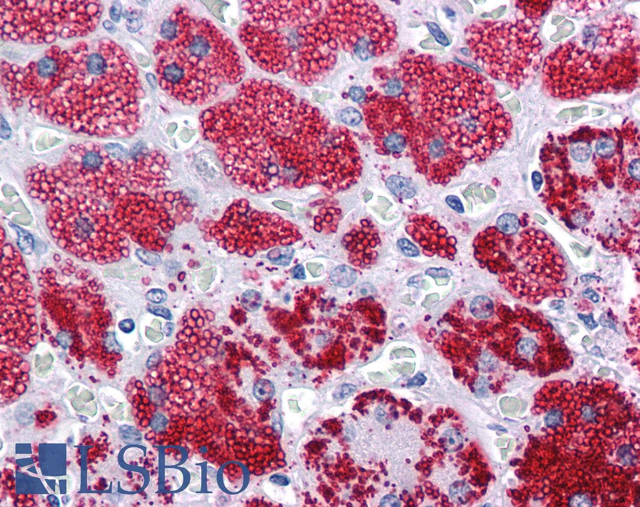 PathPlus™ Polyclonal Rabbit anti-Human PLIN2 / ADFP / Adipophilin Antibody (IHC, WB)