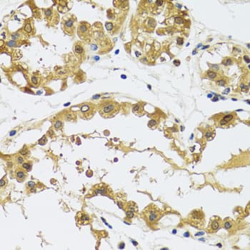 Polyclonal Rabbit anti-Human RPS12 / Ribosomal Protein S12 Antibody (IHC, IF, WB)