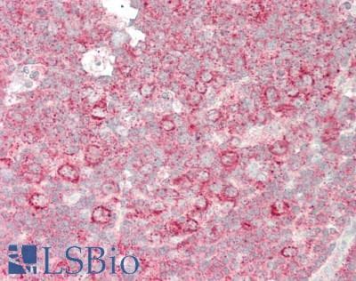 IHC-plus™ EXT1 Antibody