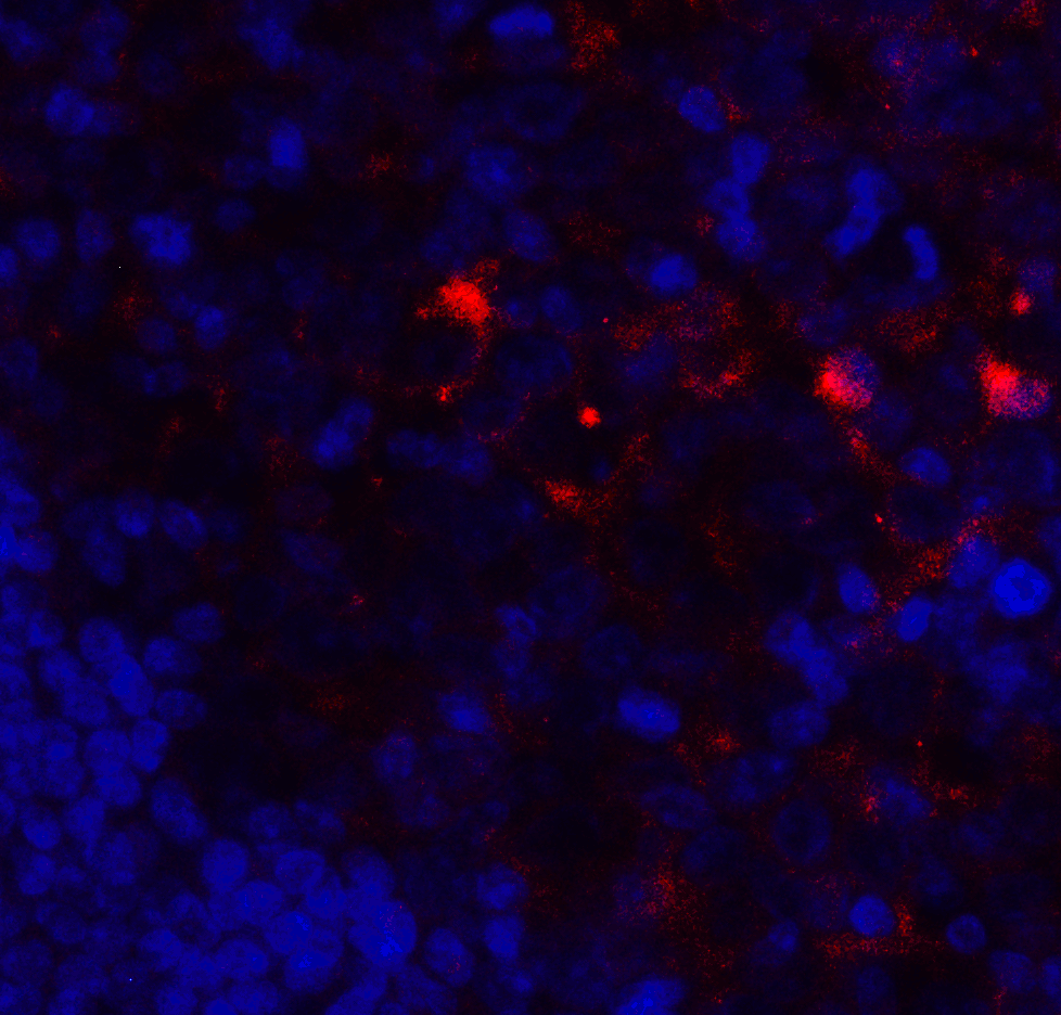 Polyclonal Rabbit anti-Human VSIR / GI24 / VISTA Antibody (IHC, IF, WB)