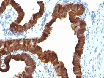 KRT7 / CK7 / Cytokeratin 7 Antibody (clone KRT7/1198)