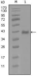 AR / Androgen Receptor Antibody (clone 1A9D12)