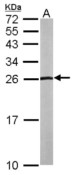 Polyclonal Rabbit anti-Human SLC9A3R2 / SIP1 Antibody (aa82-307, WB)