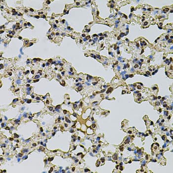 CREBBP / CREB Binding Protein Antibody