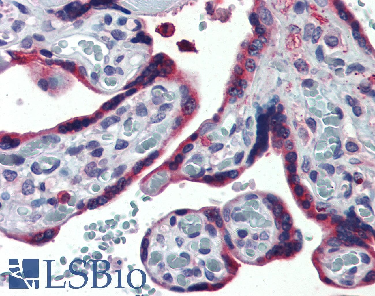 IHC-plus™ Polyclonal Rabbit anti-Human ERP44 Antibody (Internal, IHC)