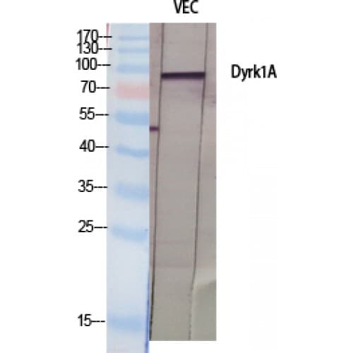 DYRK / DYRK1A Antibody (40-120 aa, N-terminal)