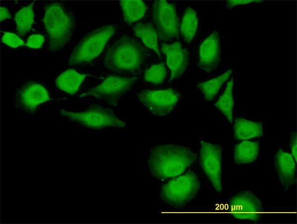 IHC-plus™ Monoclonal Mouse anti-Human TXN / Thioredoxin / TRX Antibody (clone 2A7, IHC, IF, WB)