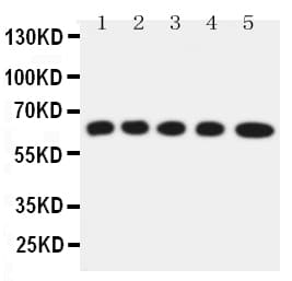 Polyclonal Rabbit anti-Mouse SLC22A5 / OCTN2 Antibody (aa531-547, WB)