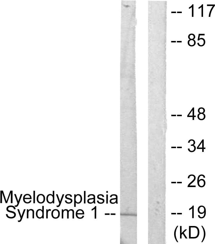 Polyclonal Rabbit anti-Human MECOM / EVI1 Antibody (WB)