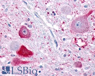 PathPlus™ NPFFR1 / GPR147 Antibody (Extracellular Domain)
