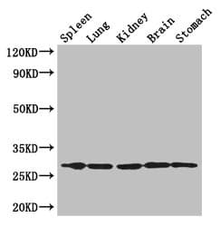 TMEM7 / RTP3 Antibody