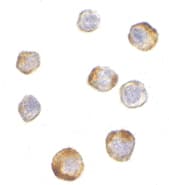 Polyclonal Rabbit anti-Human TRIM25 Antibody (IF, WB)