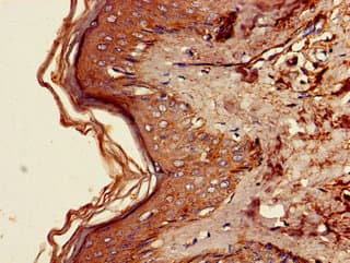 IHC-plus™ Polyclonal Rabbit anti-Human FAM134B Antibody (IHC)
