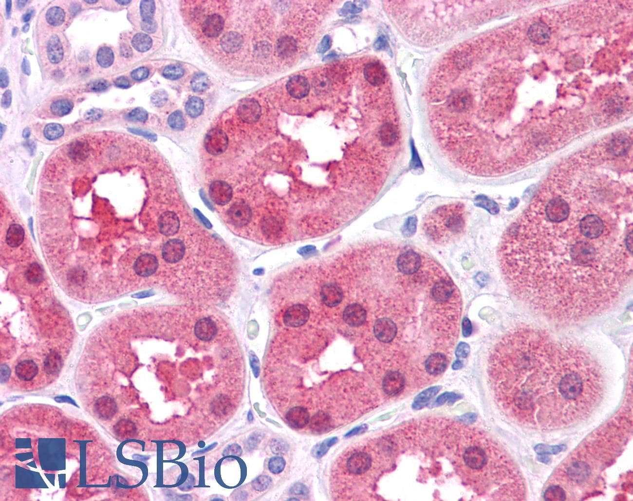 Polyclonal Rabbit anti-Human DBT / E2 Antibody (aa35-84, IHC, WB)