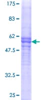 Human VWF / Von Willebrand Factor Protein (Recombinant GST)