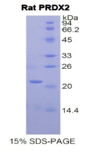 Rat PRDX2 / Peroxiredoxin 2 Protein (Recombinant His)